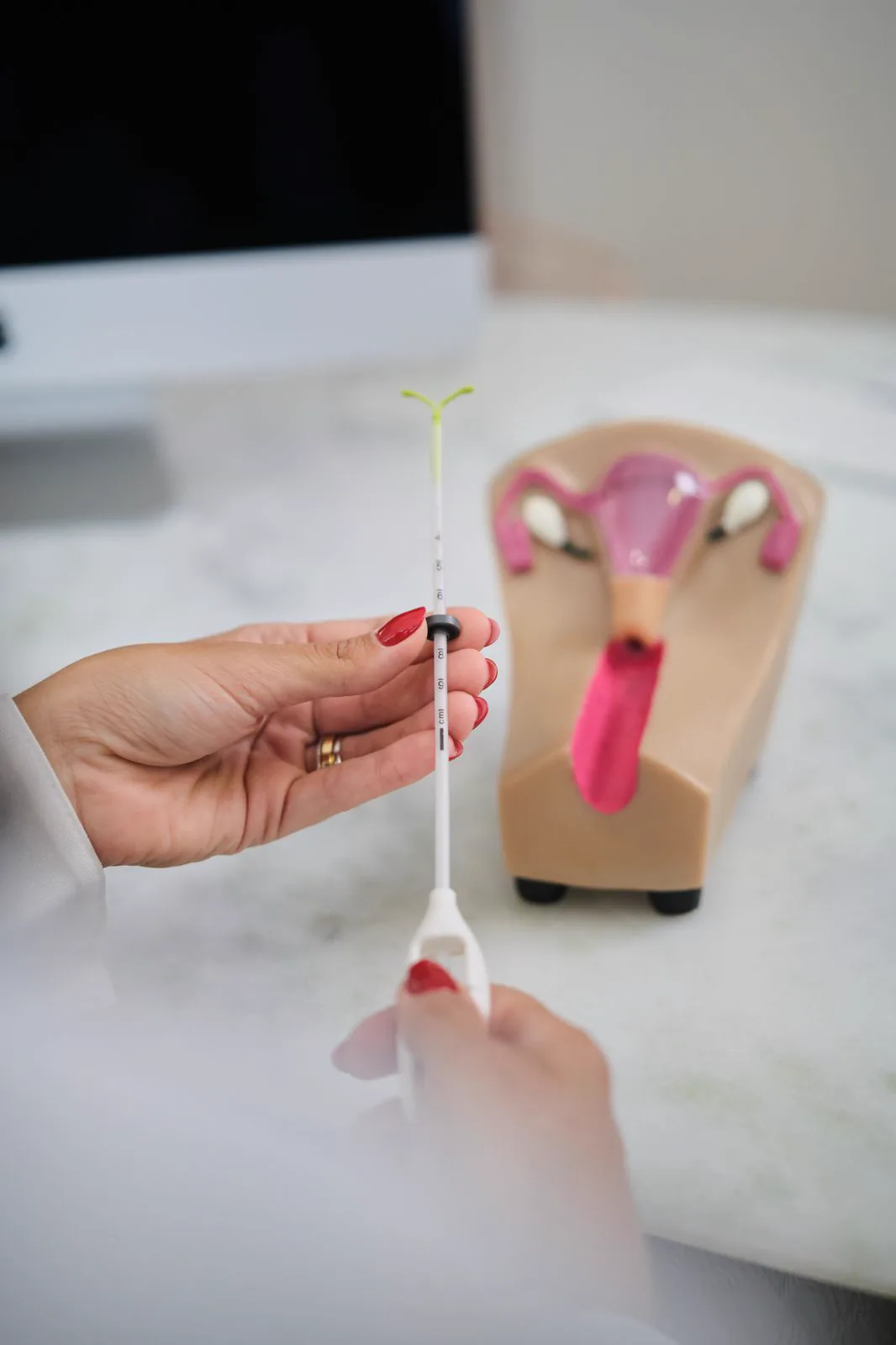 DIU e implante contraceptivo